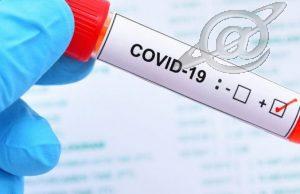 Covid – Boletim epidemiológico